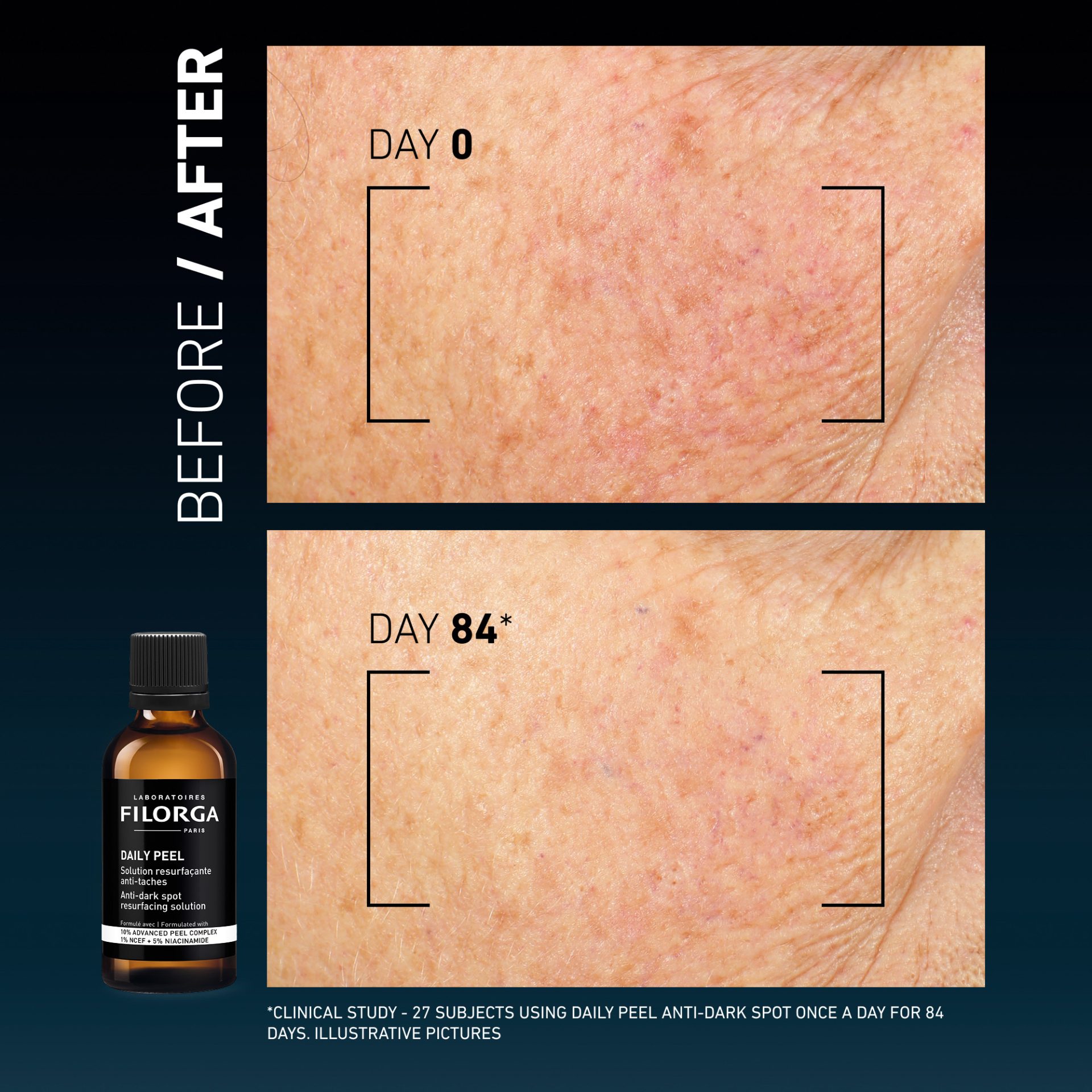 FILORGA DAILY PEEL ANTI- DARK SPOT SOLUTION 50ML - Image 4