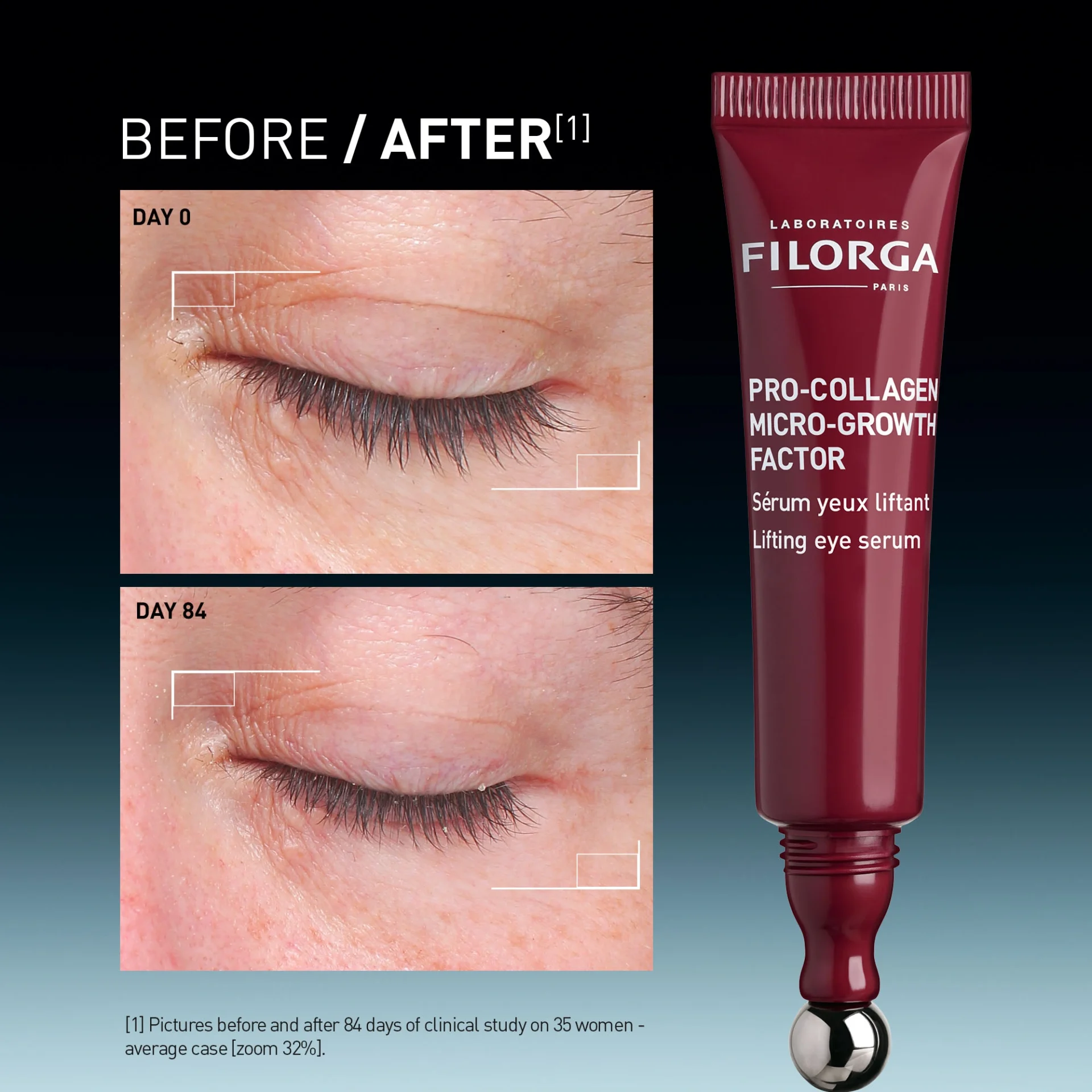FILORGA COLLAGEN GROWTH FACTOR Protocol Eye Serum 15ml - Image 4